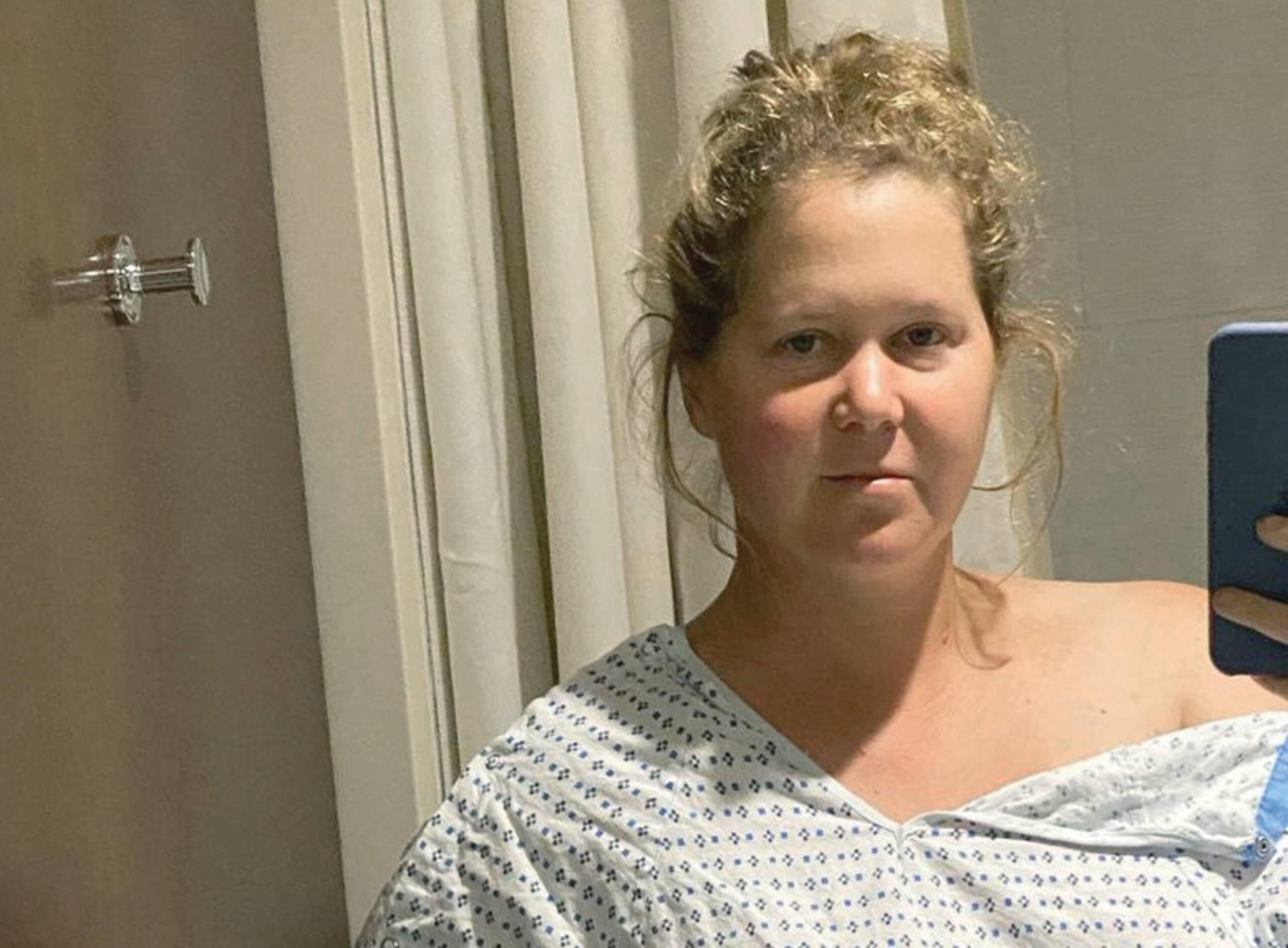 Une opération difficile pour Amy Schumer