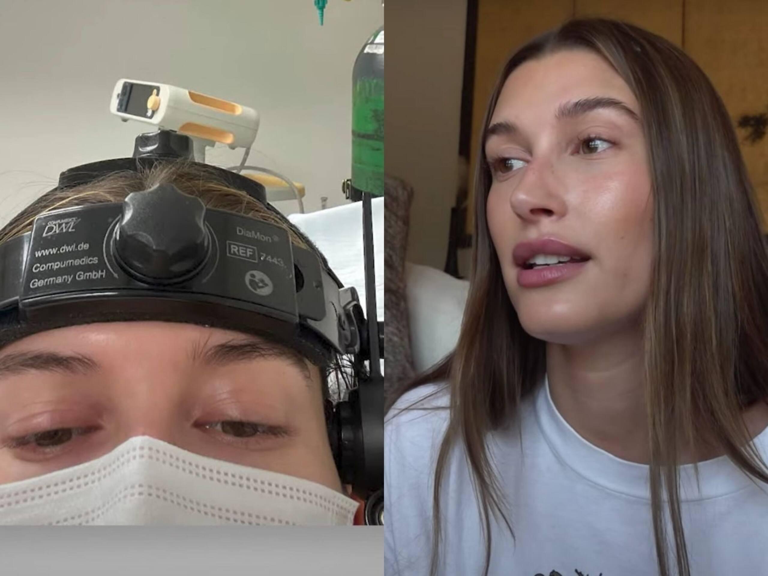 Hailey Bieber victime d'un caillot au cerveau